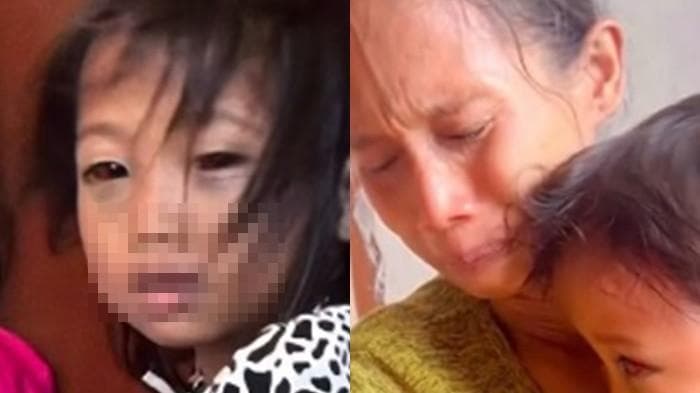 Kasus Dugaan Kekerasan guru di SDN 150 Palembang, Siswi Alami Lebam di Wajah